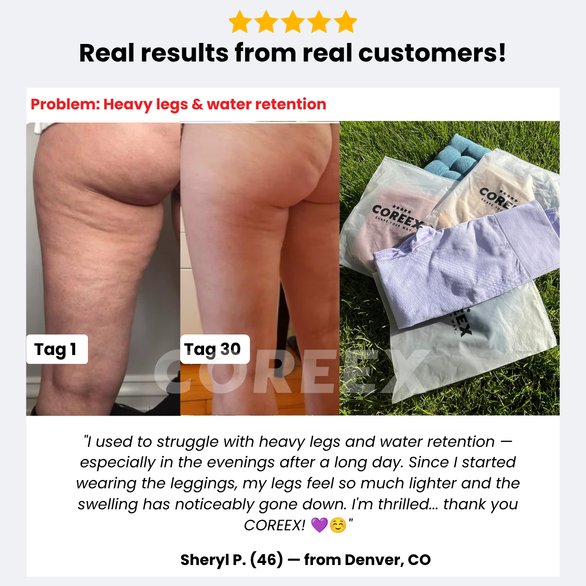 COREEX CelluFlex™ 3D-Compressionshorts 2.0