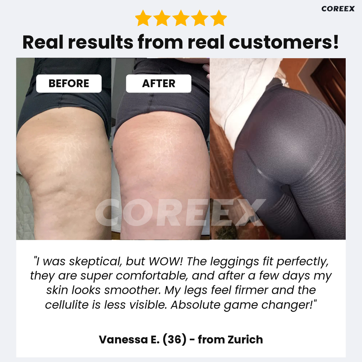 Vanessa E. before and after wearing CelluFlex