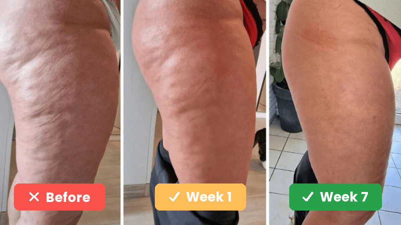 Before, week 1 and week 7 comparison