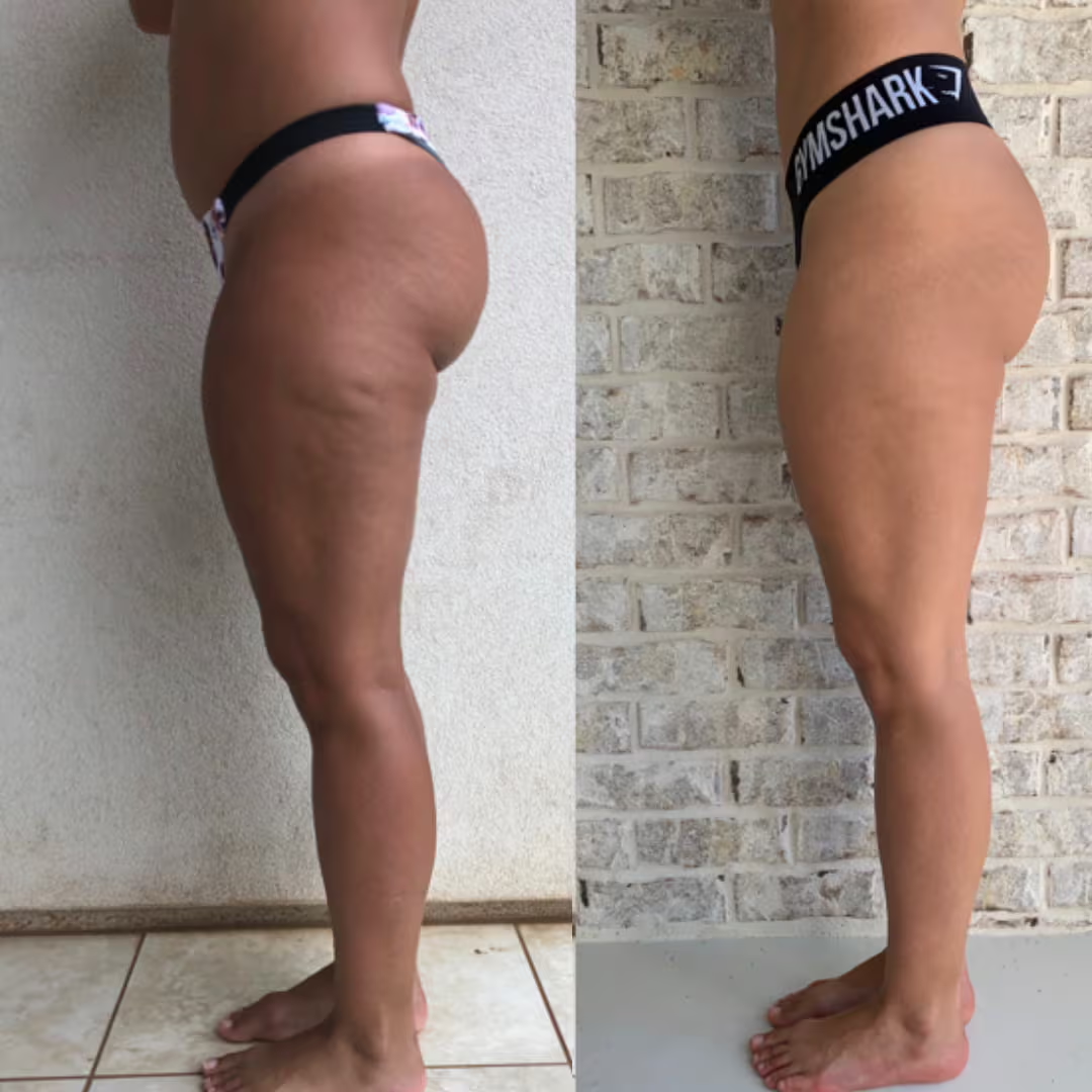 Customer before and after, side profile